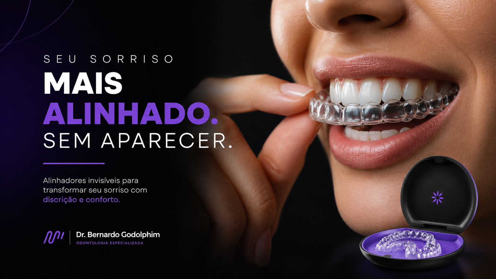 Aparelhos Invisíveis para alinhamento dentário